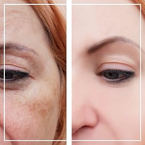 Targeted Pigmentation Reduction