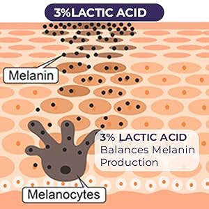 Lactic Acid