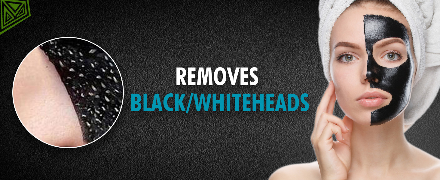 Removes black/whiteheads